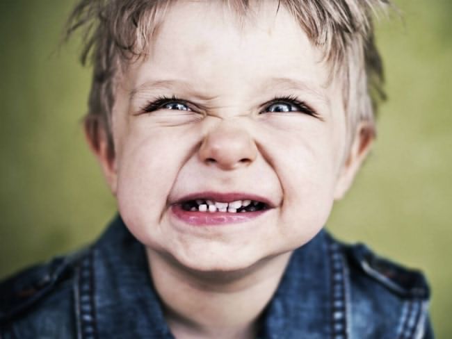 عوامل ایجاد دندان قروچه در کودکان